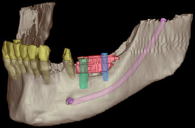 Diagnostik 3d